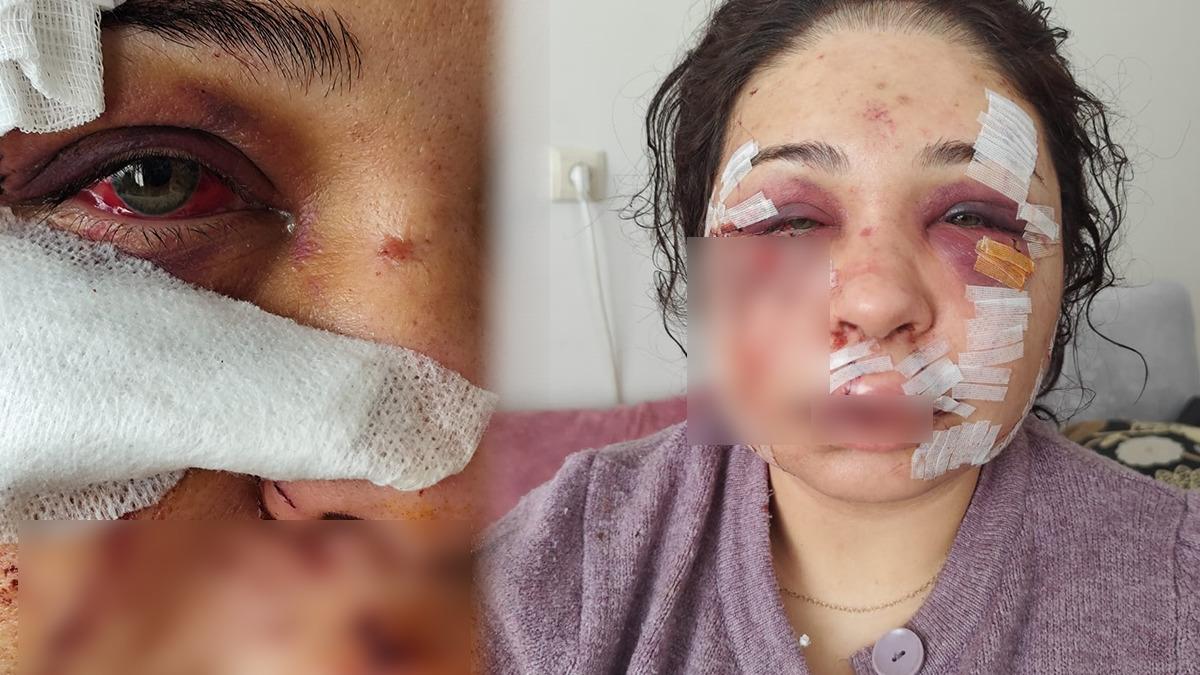 Polis eşi